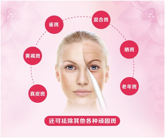 科技与生活的完美融合，最新斑美拉消息更新